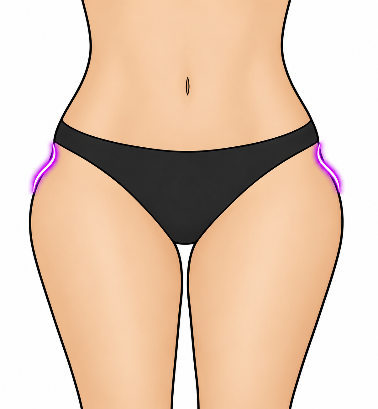 Mild hip dips